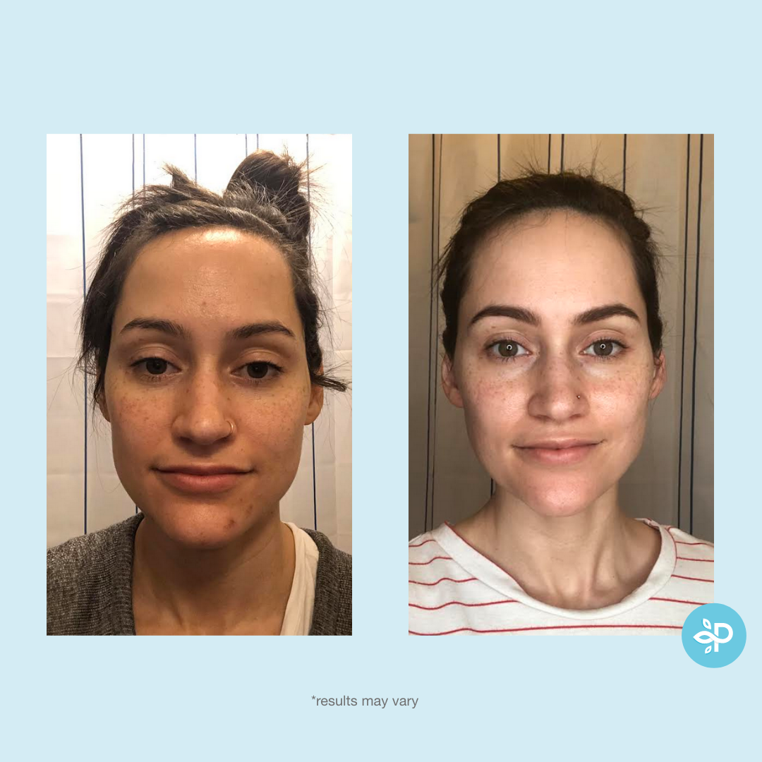 Perfect Image - Tri-Clarity Peel Pads - Level 1