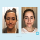 Perfect Image - Tri-Clarity Peel Pads - Level 1