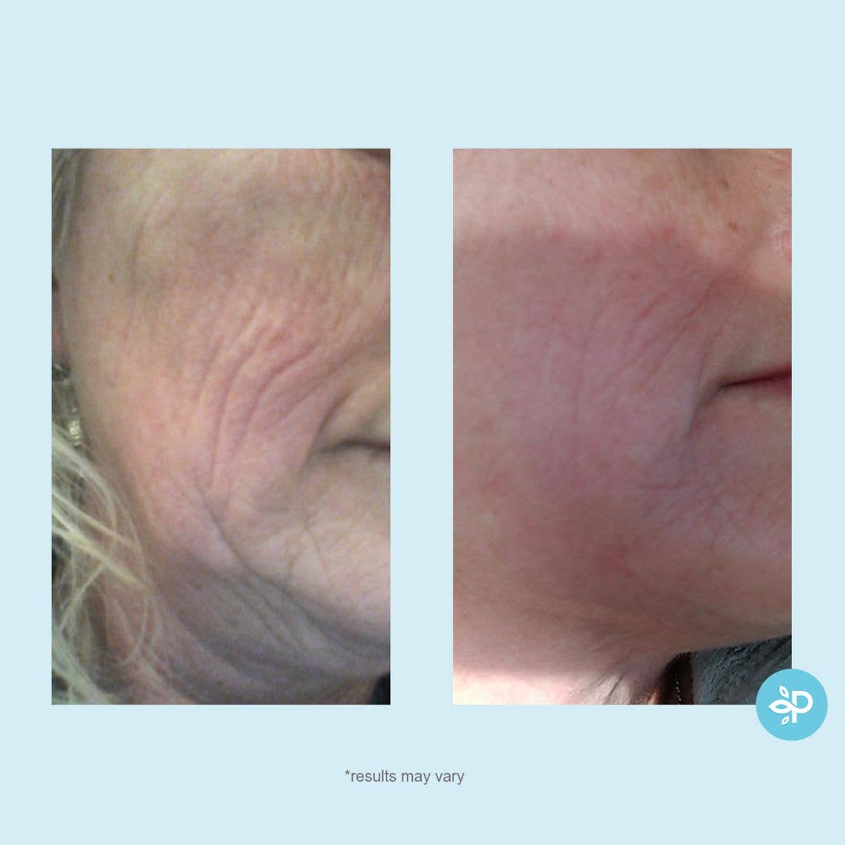 Perfect Image - Hydra-Repair Wrinkle Cream