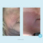 Perfect Image - Hydra-Repair Wrinkle Cream